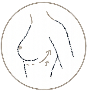 Cirugía de busto según tu anatomía