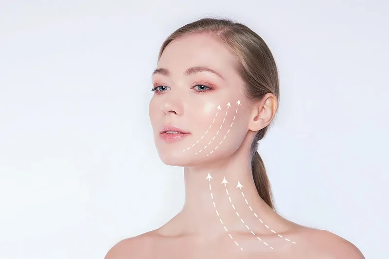 Estiramiento Facial en CDMX